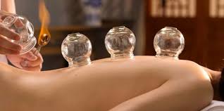 Cupping Therapy